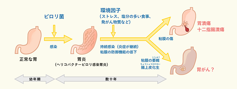 （出典）大塚製薬 ピロリ菌について